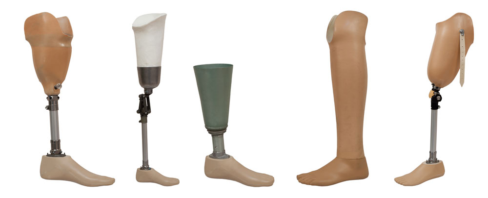 prosthetics-creative-prosthetics-orthotics